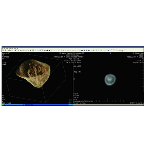 GALIL應(yīng)用案例&mdash;&mdash;TechniScan使用Galil控制器促成精確無(wú)痛的乳房檢查